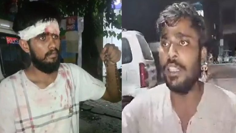 गले में रुद्राक्ष की माला देख मस्जिद के पास भीड़ ने पूछा नाम, पीटकर किया लहूलुहान: मेरठ में डिलीवरी बॉय और उसके दोस्त पर हमला