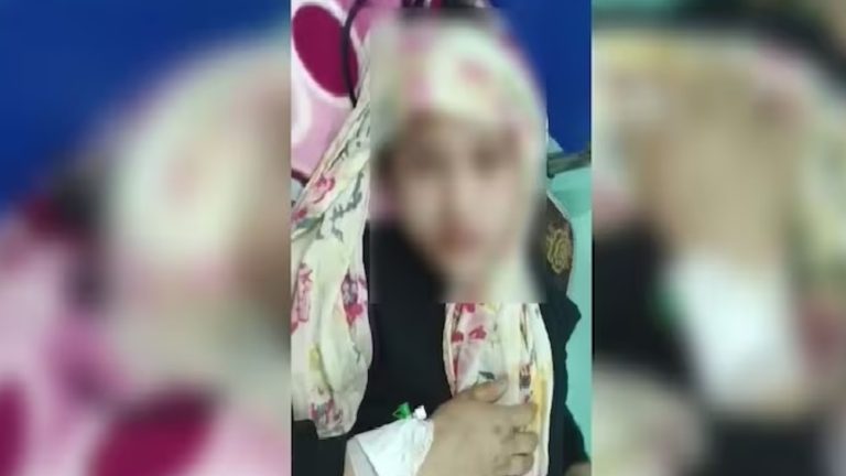 गर्म पानी से जलाया, जबरन उतरवाए कपड़े; नाक, जीभ और दाँतों में जख्म: मेजर और पत्नी ने नाबालिग मेड को किया प्रताड़ित, महिलाओं के प्रदर्शन के बाद गिरफ्तार