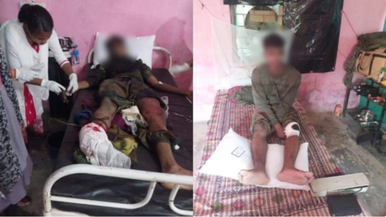 छत्तीसगढ़ के दंतेवाड़ा में नक्सिलयों के हमले में जवान के पैर के चीथड़े उड़े, दूसरे को लगे छर्रे: बस्तर सुरक्षाबलों ने 10 किलो का IED किया निष्क्रिय