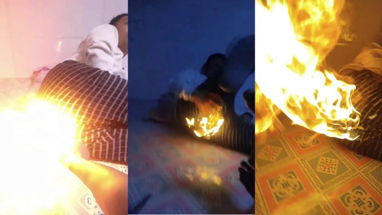 लाइटर के सामने छोड़ी गैस, जल गया पिछवाड़ा: वीडियो में चले थे प्रैंकस्टर बनने, अब ठीक से बैठना भी मुश्किल