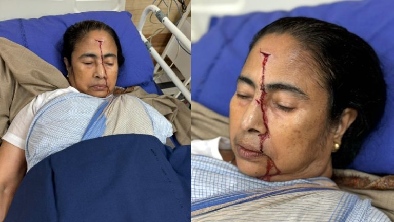ललाट से लेकर गले तक कटे का निशान, दिख रहा खून वाला लाल रंग… अचानक घायल हुईं ममता बनर्जी अस्पताल में भर्ती, विधानसभा चुनाव से पहले भी हुई थीं चोटिल