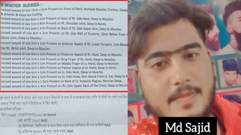 साँस नली कटी हुई, सर पर कट, गले पर वार, कंधा हड्डी तक कटा हुआ: पोस्टमॉर्टम रिपोर्ट खौफनाक, हाथ-उँगलियों के निशान बता रहे हिंदू बच्चों के साहस-संघर्ष