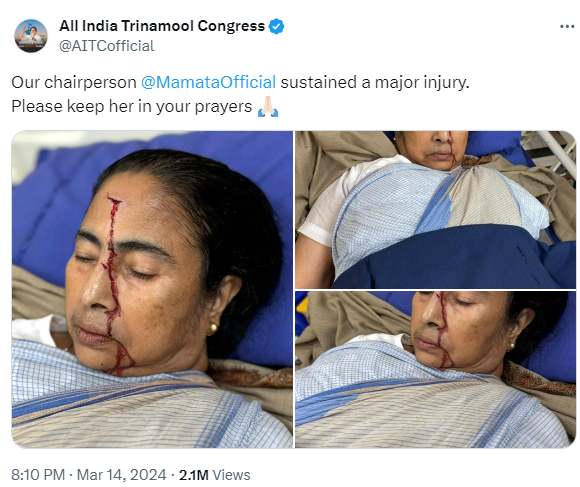 ममता बनर्जी चोट