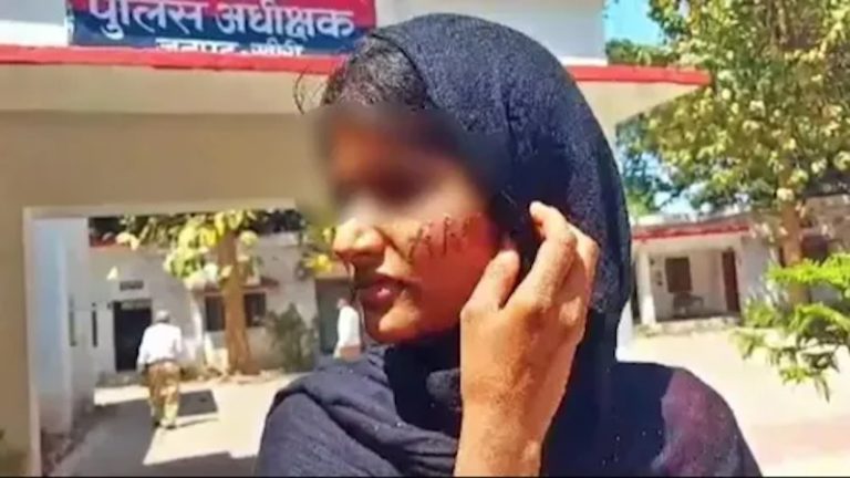 14 साल की लड़की को कमरे में बंद किया, गाल पर गोद कर लिख दिया अपना नाम: मस्जिद के सामने से ले गया अलीम का बेटा अमन, विरोध करने पर पीटा