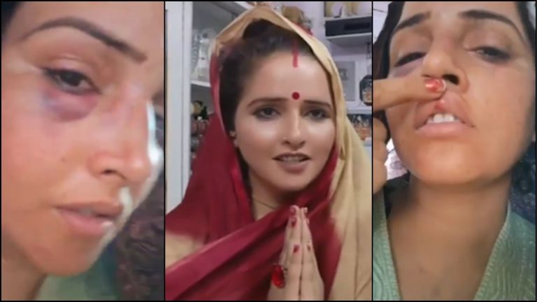 चेहरा सूजा, चोट के निशान… दावा- चरस पीकर पीटता है सचिन: बोली सीमा हैदर- रमजान में भी फैला रहे झूठ, मैं महाराज जी के सरंक्षण में सुखी हूँ