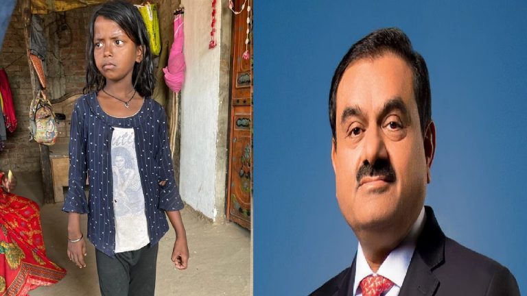 कौन है छोटी सी बच्ची लवली, कितना कठिन है उसका संघर्ष, गौतम अडानी को मदद के लिए क्यों आना पड़ा आगे: जानिए सब कुछ