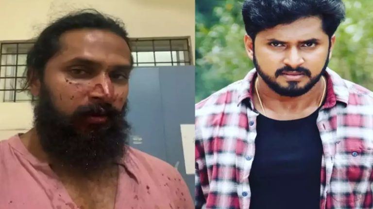 8 पैक एब्स से जिस हीरो की पहचान, पीटकर उसके नाक की हड्डी तोड़ी: खून से लथपथ Video किया शेयर, कहा- माँ के साथ मंदिर से लौट रहा था तो हुआ हमला