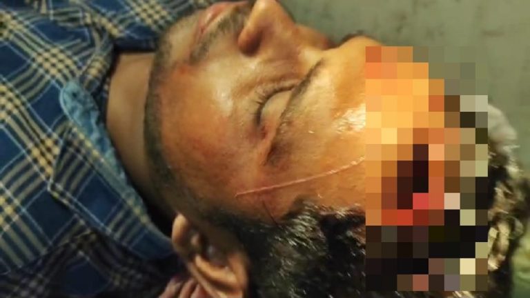 पश्चिम बंगाल में पत्थरबाजी में फूटा ANI के पत्रकार का सर, कई घायल: बमबाजी-मारपीट के बीच आखिरी चरण में 1 बजे तक 40% मतदान