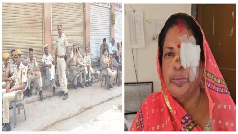 हनुमान मंदिर के सामने ईदगाह का दूसरा गेट खोलने पर अड़े थे कट्टरपंथी: विरोध के बाद शुरू कर दी हिंसा, हिंदू महिला ने आँख की रोशनी गंवाई, पुलिसकर्मी की सर्जरी