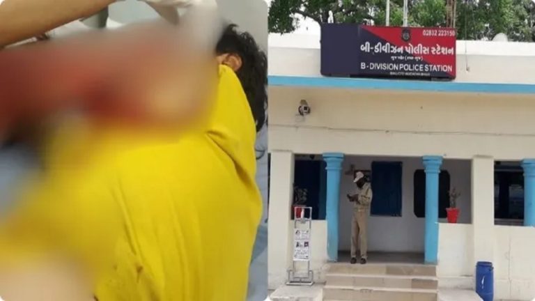 निजाम और इरफान ने हिंदू युवक का चाकू से गला काटा, VHP कार्यकर्ता के साथ ‘सर तन से जुदा’ की कोशिश: पुलिस ने दबोचा