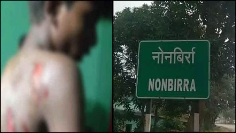 मुहर्रम जुलूस में हुआ विवाद तो हिंदू नाबालिग को जलती भट्ठी में झोंका, भाई को भी जलाने का प्रयास: छत्तीसगढ़ के कोरबा का मामला, जाँच में जुटी पुलिस