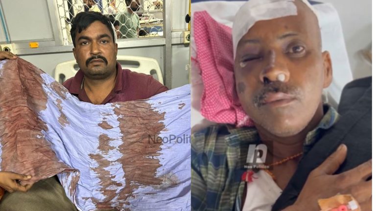 मस्जिद से आए हमलावर, सर पर धारदार हथियार से किया वार: सुधाकर तिवारी से सुनिए बहराइच में दुर्गा विसर्जन जुलूस पर कैसे हुआ हमला, अस्पताल में चल रहा है इलाज
