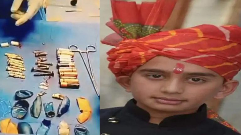 बैट्री, ब्लेड, काँच, सिक्के, नट-बोल्ट… हाथरस के 13 साल के आदित्य शर्मा के पेट से निकले 56 सामान, पर जान नहीं बचा पाए दिल्ली सफरदरजंग के डॉक्टर