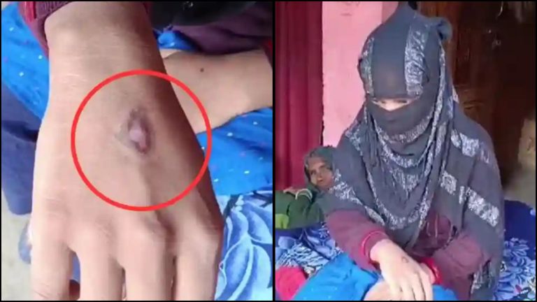 हिंदू लड़कियों को मुसलमान बनाने से जन्नत… और पैसा भी: मुरादाबाद में 14 साल की दलित बच्ची ने बताया कैसे 4 मुस्लिम लड़कों ने 2 महीने तक गोमांस खिलाकर किया रेप
