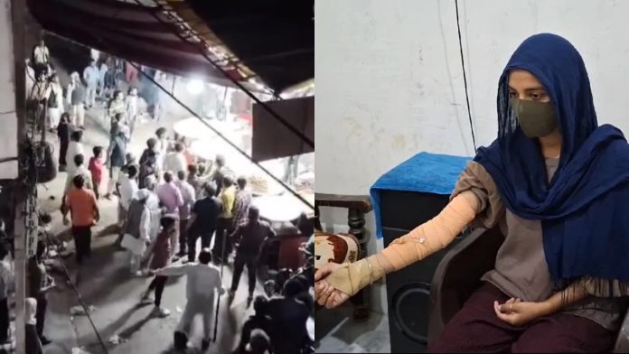 नाबालिग का जला हाथ, हमला करते आरोपित (बाएँ)
