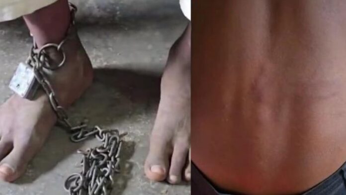 दरभंगा मदरसे बच्चों मौलाना मारपीट लोहे